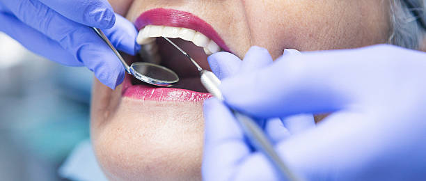 Best Dentist for Tooth Abscess  in Battle Ground, IN